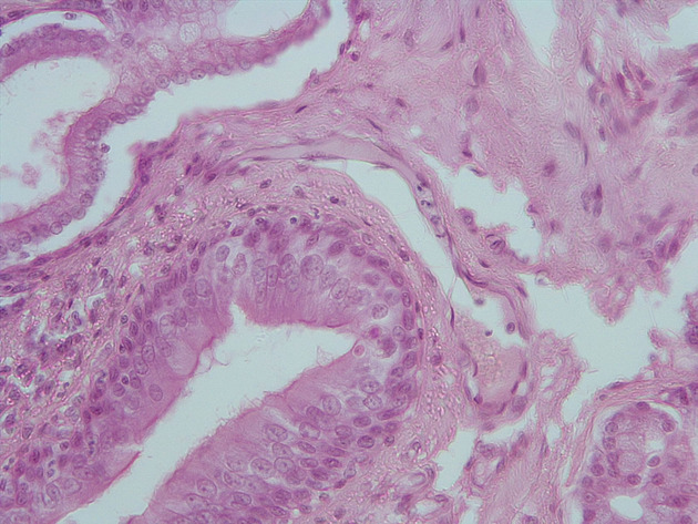 Trachea Slides - Trachea 09 400X